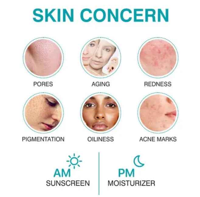 She Essentials 10% Niacinamide Facial Serum – Oil Control, Brightening & Repair For All Skin Types 30ml - Agorge