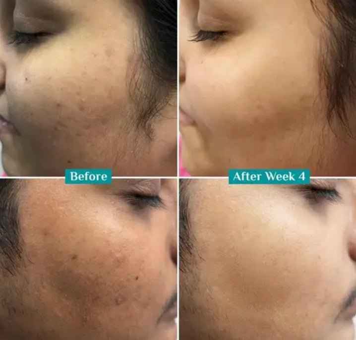 Pilgrim 10% Vitamin C Face Serum (10 ml) - Brightening & Anti-Aging Facial Serum with Kakadu Plum Extract