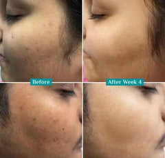 Pilgrim 10% Vitamin C Face Serum (10 ml) - Brightening & Anti-Aging Facial Serum with Kakadu Plum Extract