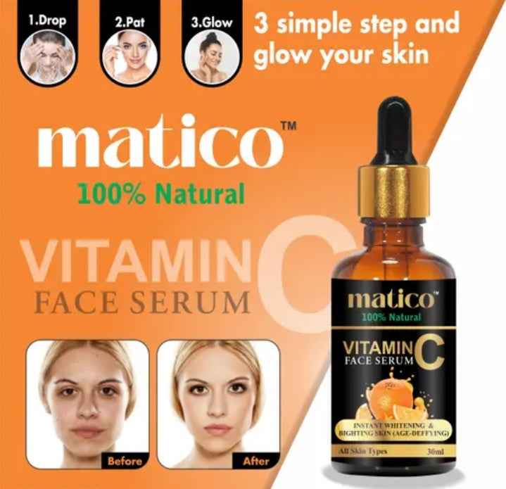 Matico Vitamin C Face Serum with Hyaluronic Acid & Aloe Vera - Brightening Anti - Aging Serum for Glowing Skin - 30ml - Agorge